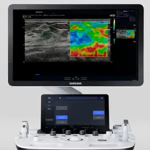 Ultrassom Doppler